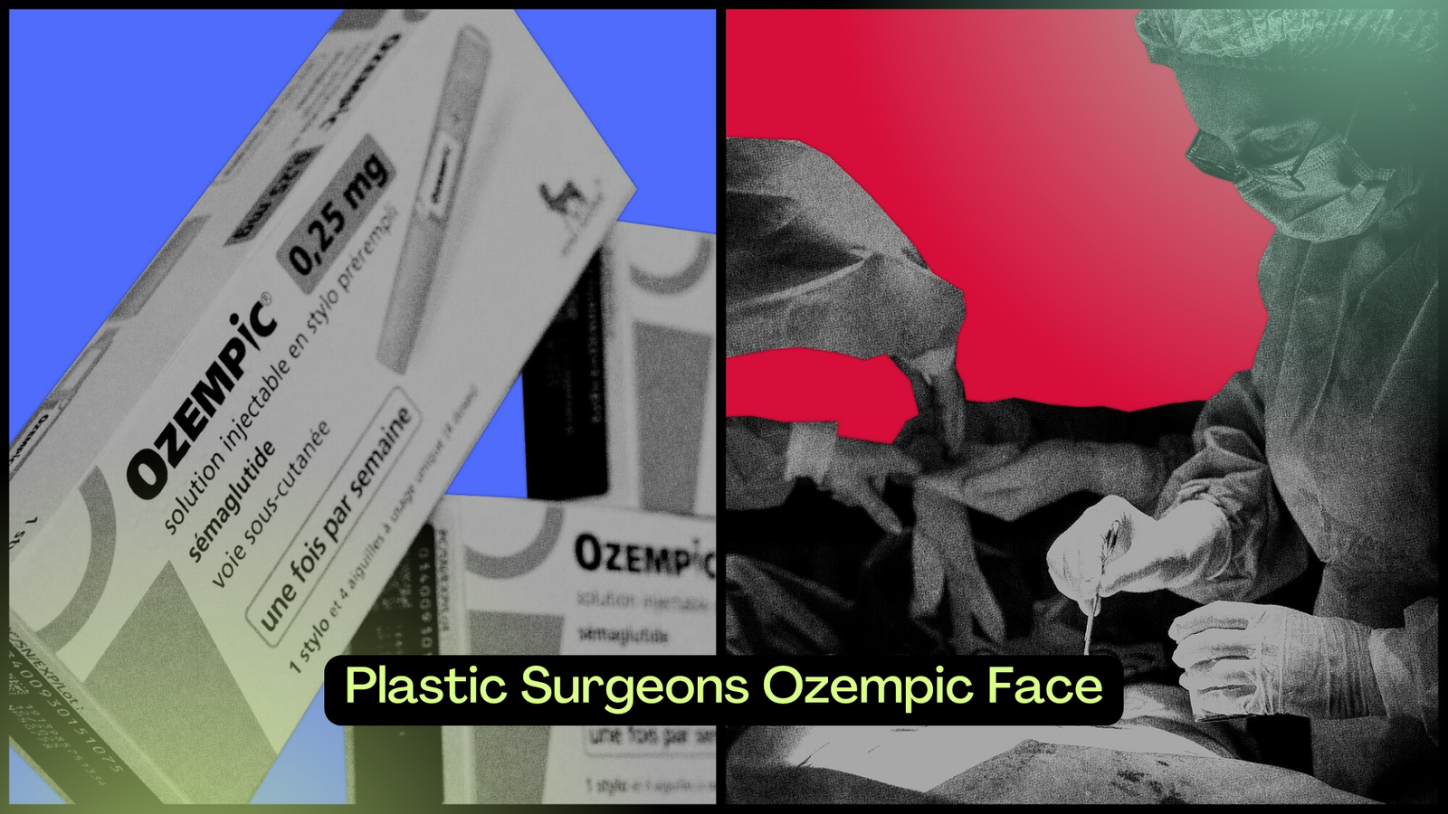 Plastic Surgeons Ozempic Face